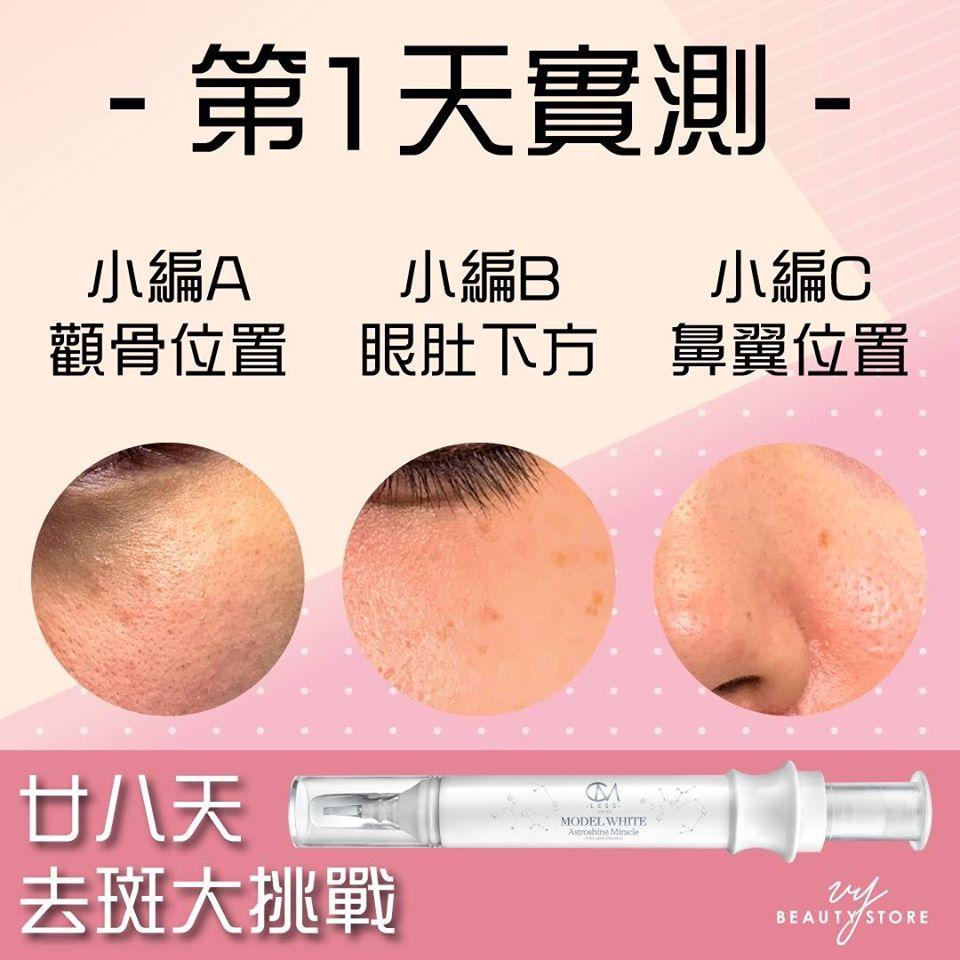 28日去斑美白实测—第1天的成果