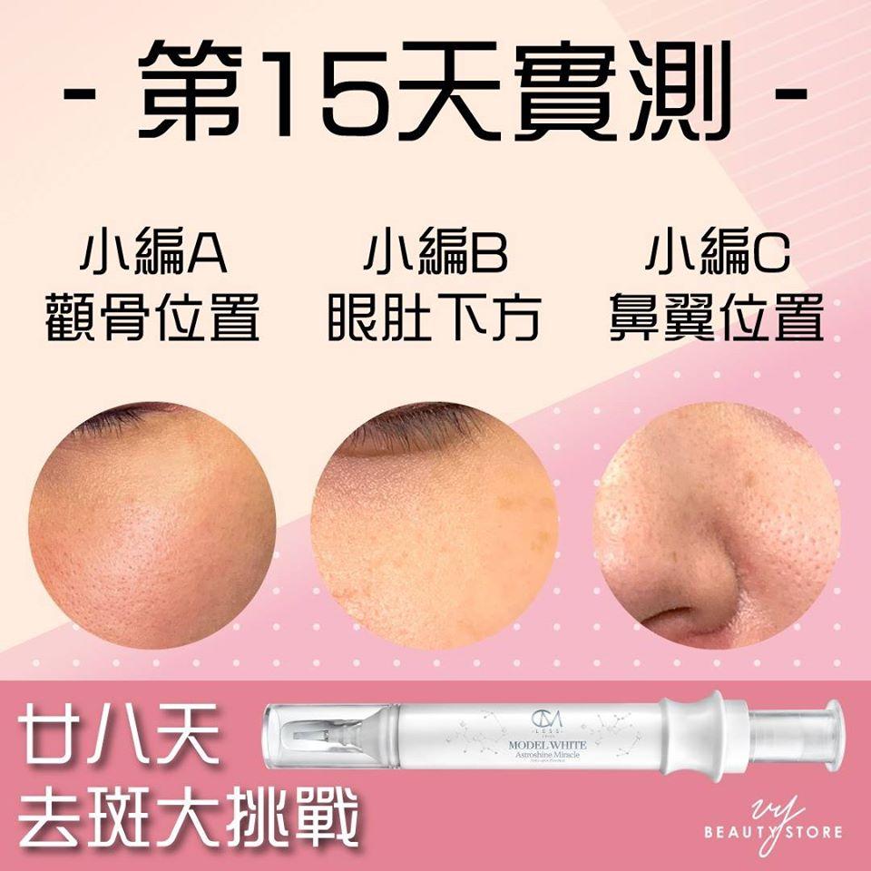 28日去斑美白实测—第15天的成果