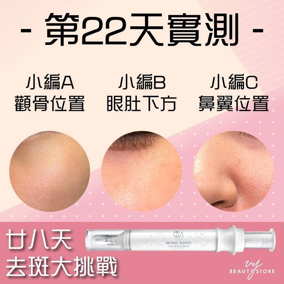 28日去斑美白实测—第22天的成果
