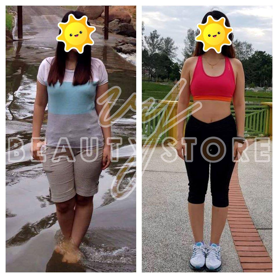 真实个案分享—运动形女生E小姐的故事