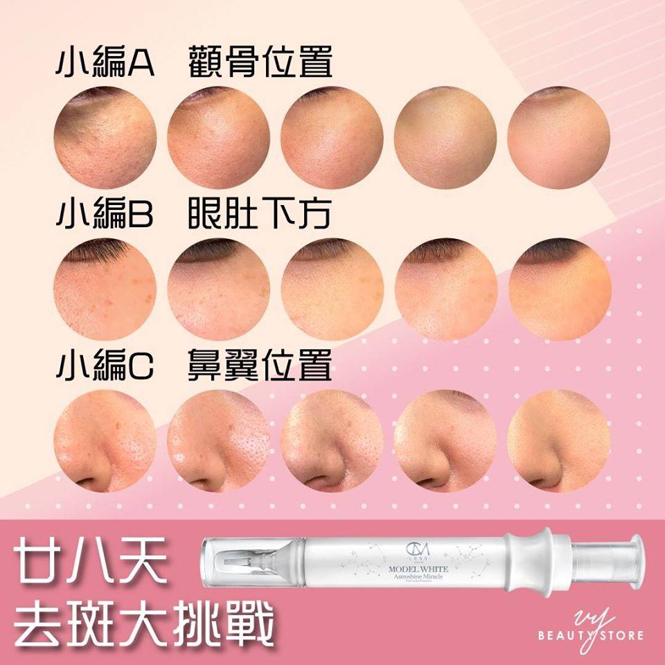 28日去斑美白实测大结局!天啊好紧张!到底结果是怎样呢?