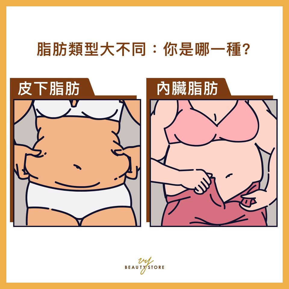 脂肪类型大不同:你是哪一种?