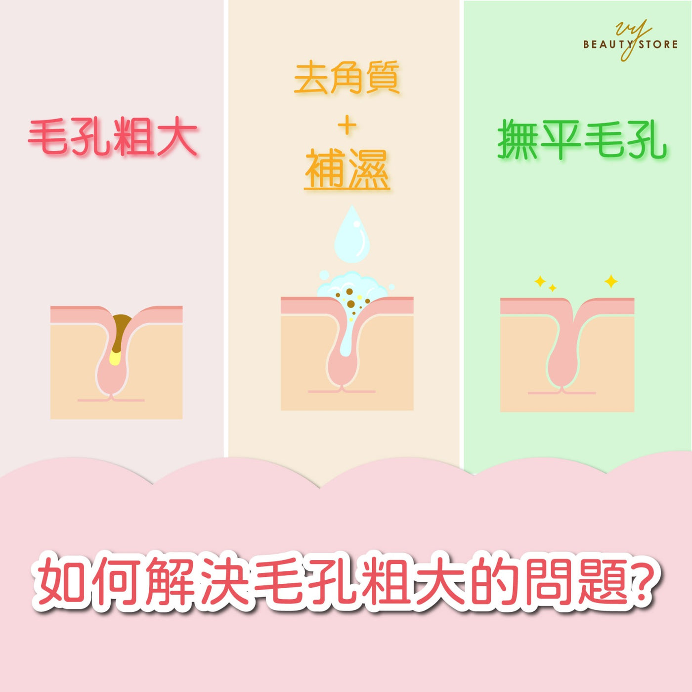 如何解决毛孔粗大的问题?