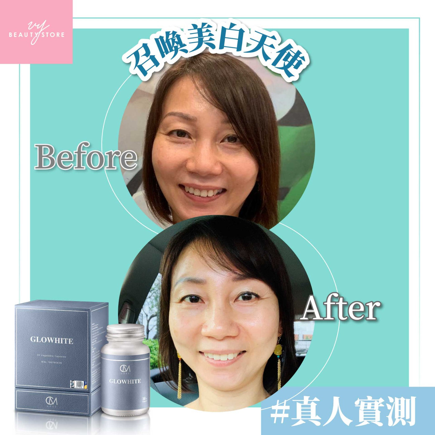 🤩全身美白报告3-真人实测