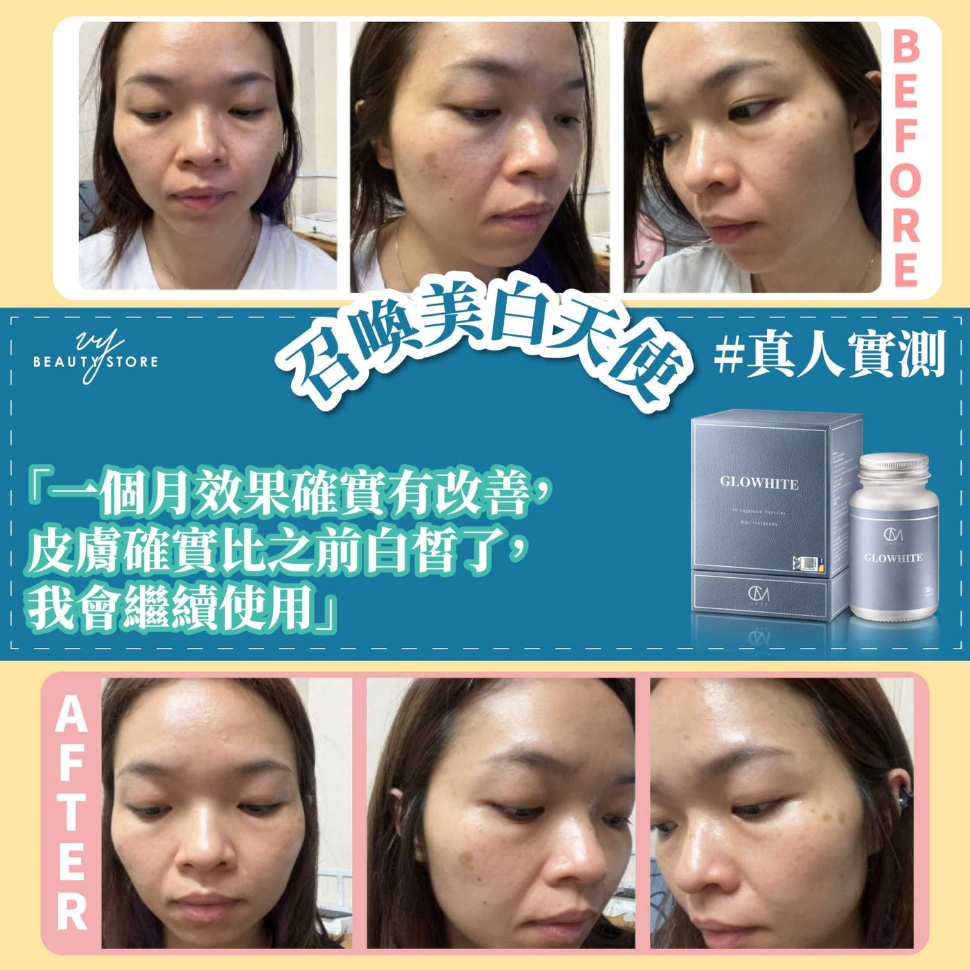 全身美白报告6-真人实测