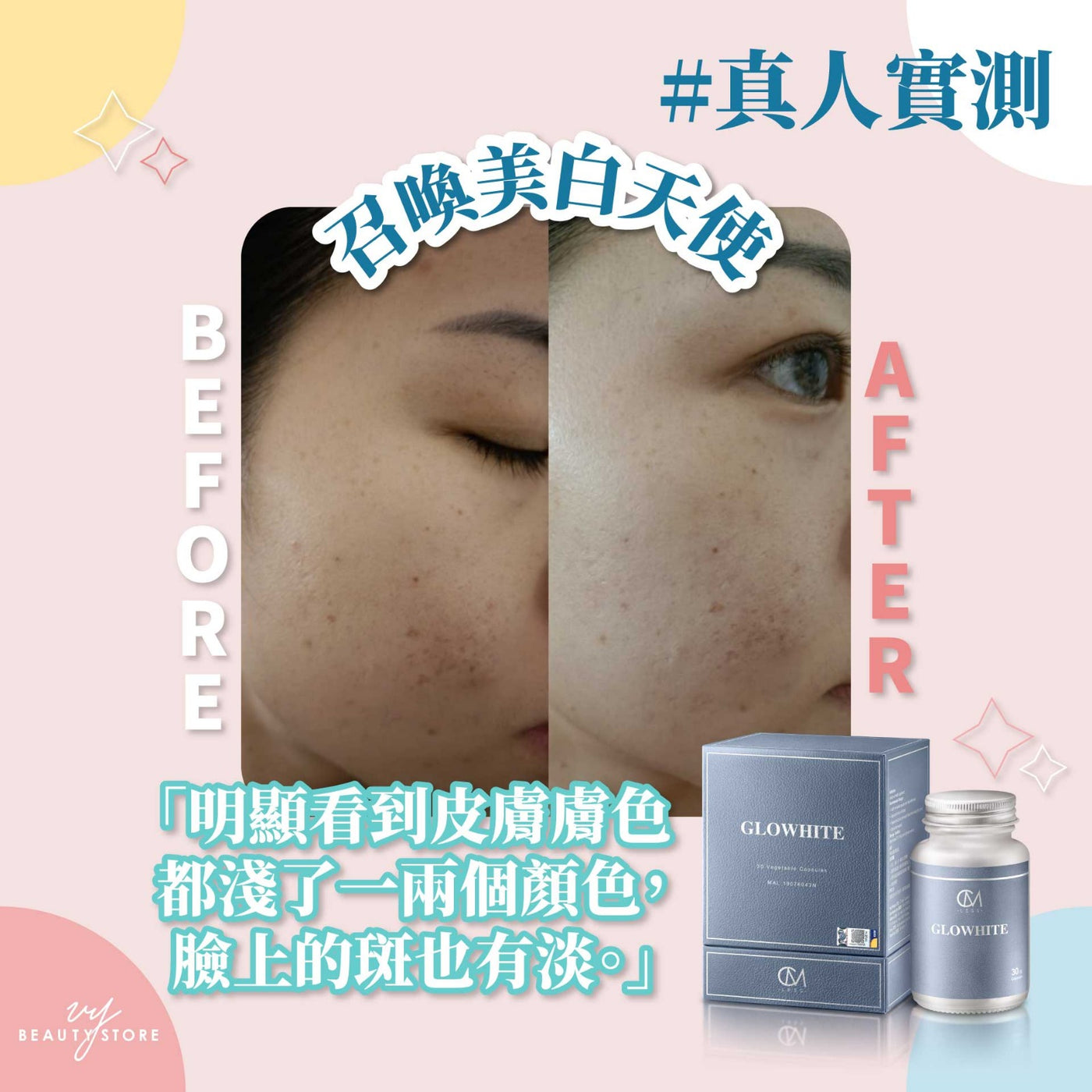 🤩全身美白报告5-真人实测