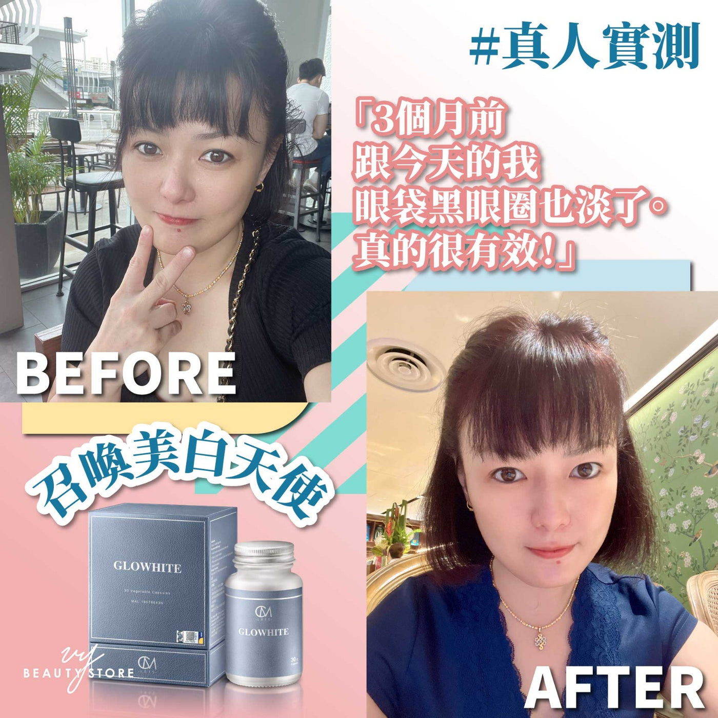 🤩全身美白报告4-真人实测