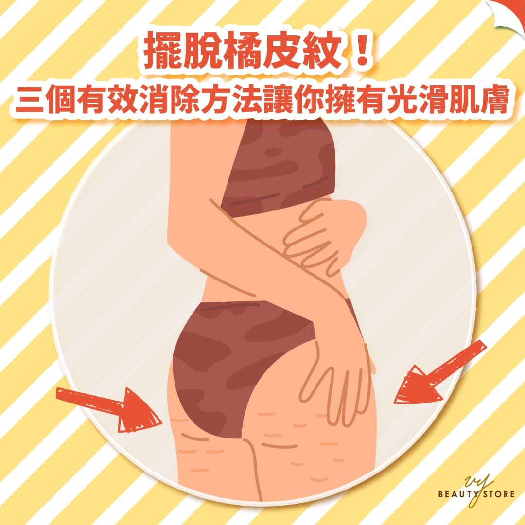 摆脱橘皮纹!三个有效消除方法让你拥有光滑肌肤